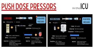 Push Dose Vasopressors For Management Of Shock In The ICU [upl. by Llehcar]