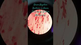 Gram Negative Bacteria in Gram Staining of Sputum Microscopy at various magnifications [upl. by Ordnajela]