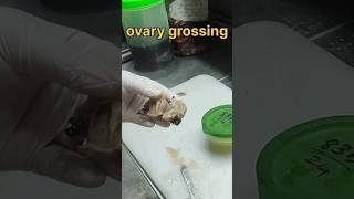 Ovary grossing video  histopathology ovariancyst cyst ovaryhistology [upl. by Blain865]