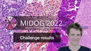 MIDOG 2022 Insights from the Challenge Report [upl. by Ennovehc530]