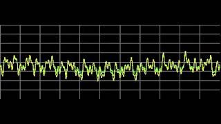 Kidney Diseases  Rife Frequencies [upl. by Candless]