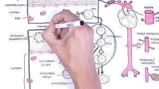 Vasculitis Pathophysiology Overview [upl. by Woodberry]