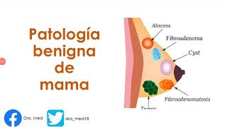 PATOLOGIA BENIGNA DE MAMA FIBROADENOMA MASTOPATÍA FIBROQUÍSTICA REPASO ENARM 🤓 [upl. by Anirda]