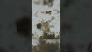 Rotifer filtering water microscopy short [upl. by Ettenhoj782]