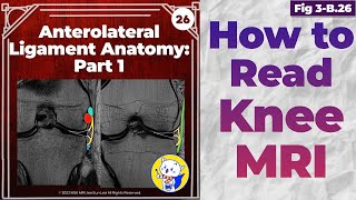 Fig 3B26 Anterolateral Ligament Anatomy [upl. by Swift]