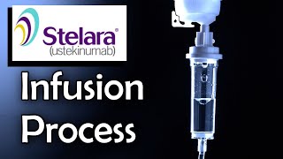 Stelara Infusion Process Ulcerative Colitis Treatment [upl. by Cirederf]