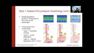 ANMS Clinical Virtual Webinar  Esophageal Manometry When Why and How [upl. by Eibor427]