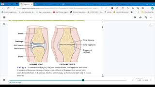 4346 CONCEPTS OF CARE FOR PTS WITH ARTHRITIS AND TOTAL JOINT ARTHROPLASTY PART 1 [upl. by Pol]