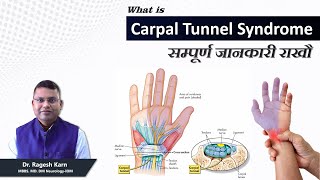 Causes of Hand Pain in Nepali  हात दुख्ने समस्या  Carpal Tunnel Syndrome [upl. by Yllah]