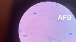 acid fast bacilli under microscope mycobacterium tuberculi mycobacterium tbtuberculosisAFB stain [upl. by Arehc]