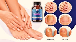 NANO DEFENSE PRO REVIEWS ⛔ Advanced Nail Fungus Treatmen ⛔ NANO DEFENSE PRO  NANODEFENSE [upl. by Desdee]