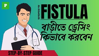 FISTULA IN ANO  How to do Dressing Fistula Treatment Care and Recovery [upl. by Aeslek386]