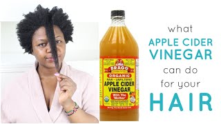 How To Do An ACV Rinse Apple Cider Vinegar On Natural Hair [upl. by Meill]