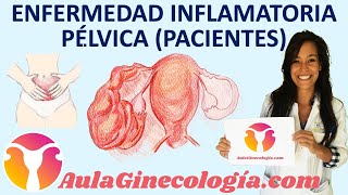 ENFERMEDAD INFLAMATORIA PÉLVICA EPI PACIENTES síntomas y tratamiento Ginecología y Obstetricia [upl. by Reeva]