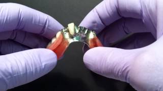 Soft Lining for Partial Dentures [upl. by Aihseym942]