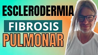 FIBROSIS PULMONAR  ESCLERODERMIA  Tratamiento  Dr Ludwig Johnson [upl. by Hnil532]