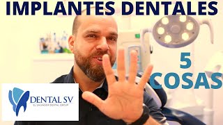 IMPLANTES DENTALES 🦷 5 Cosas que DEBES Saber 👨‍⚕ [upl. by Llezom392]