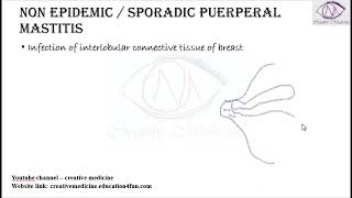 Lec 2 Puerperal Mastitis [upl. by Atram]