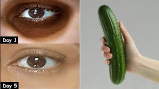 Removed DARK CIRCLES Under Eye in 5 Days with cucumber  Remove Eye Wrinkles amp Under Eye bags [upl. by Sorodoeht]