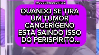 QUANDO SE TIRA UM TUMOR CANCERÍGENO ESTÁ SAINDO ISSO DO PERISPÍRITO [upl. by Aronael]