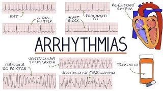 Hospital Training  Internal medicine  Arrhythmias Dr Mohammed Mahdi 20242025 [upl. by Winfred201]