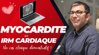 Myocardite en IRM cardiaque  tout comprendre en 15 minutes [upl. by Enedan769]