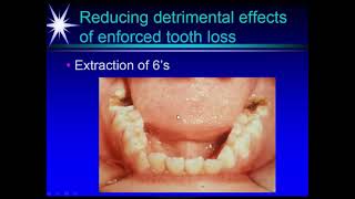 INTRAORAL EXAMINATION 2021 02 20 [upl. by Kenway]