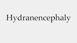 How to Pronounce Hydranencephaly [upl. by Penn1]