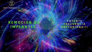 REMOCION DE IMPLANTES 🔴 Frecuencia Arcturiana 👽 Vivi Pedraglio [upl. by Backer]