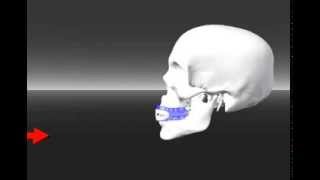 The Secret About Impacts To The Face Mask amp Jaw That Transmit To The Base of Skull [upl. by Gnivre]