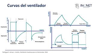 Ventilación mecánica [upl. by Alcott]