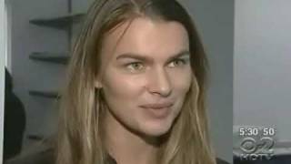 Skinny Model Filippa Hamilton I Was Fired For Being Too Fat wcco com [upl. by Sink61]