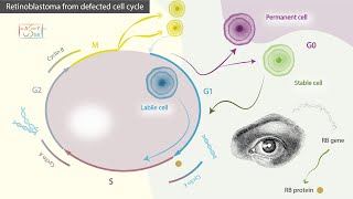 Retinoblastoma from defected cell cycle [upl. by Sedaiuqlem]