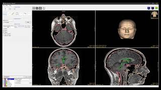 Analyze 150  Measure Selected Object [upl. by Nosro]