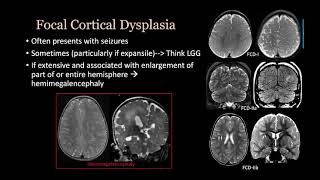 imaging Congenital malformation Brain and spine [upl. by Uile]