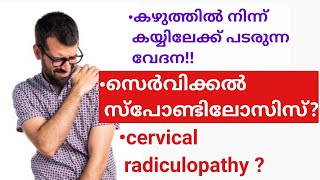 കഴുത്ത് വേദന കഴുത്തിൽ നിന്ന് കയ്യിലേക്ക് പടരുന്ന വേദന cervical spondylosis [upl. by Leirum]