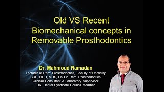 Biomechanical principles of Metallic RPD vs Flexible RPD [upl. by Henriha454]