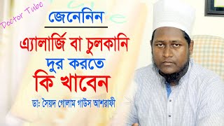 এলার্জি চুলকানি দূর করার সহজ উপায়  Allergy Treatment  Bangla Health Tips [upl. by Arnulfo]