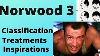 Norwood 3 Hairline Survival Guide  Classification Treatments and More [upl. by Hephzipah936]