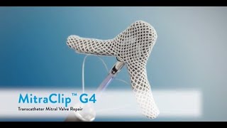 Transcatheter EdgetoEdge Repair with MitraClip™ G4 [upl. by Cahra161]