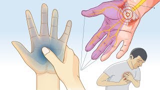 What Causes Tingling and Numbness in Hands and Feet [upl. by Naasah904]