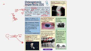 Osteogenesis Imperfecta CBL [upl. by Animlehliw185]