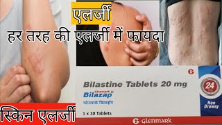 How to use Bilastine 20 mg  Dose Side effect  Benefits in hindi  Bilastine [upl. by Ttiwed]