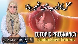 What is Ectopic pregnancy  Risk factorssymptoms and Treatment of Ectopic Pregnancy by Dr Zainab [upl. by Eniortna]