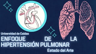 Estado del Arte Enfoque de la Hipertensión Pulmonar [upl. by Eph502]