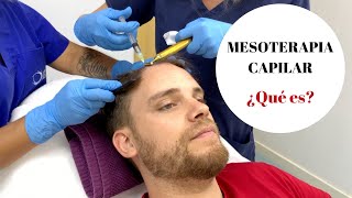 MESOTERAPIA CAPILAR ¿Qué es [upl. by Flaherty]