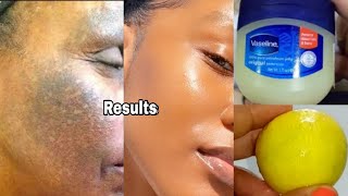 How to apply vaseline and lemon on face apply vaseline on your skin and see the magic [upl. by Nawat]