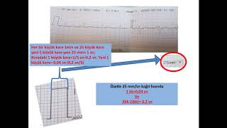 EKG Kağıdı ve Kalibrasyon [upl. by Chitkara]