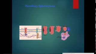 pathology  Hematology  dr Tahseen  Hemolytic Anemia  Spherocytosis [upl. by Maroney]