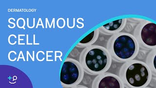 Squamous Cell Cancer Dermatology [upl. by Atnoed]